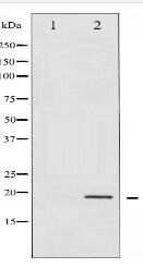 Phospho-4E-BP1 (Thr36) Antibody