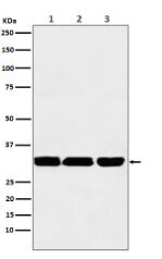 p53 DINP1 Antibody