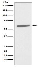 Cytokeratin 5 Antibody