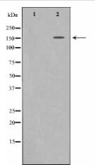 VEGFR2 Antibody