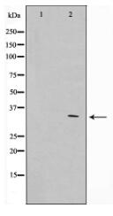 Phospho-APC(Ser2054) Antibody