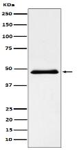 Pancreatic Lipase （PNLIP） Antibody