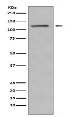 Phospho-Retinoblastoma (S780) Antibody