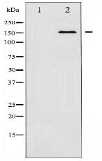 NMDAR2B Antibody