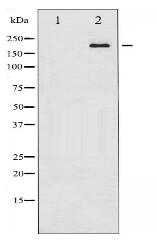 Tuberin/TSC2 Antibody