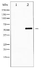 Phospho-AFX (Ser197) Antibody