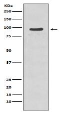 Phospho-p95/NBS1 (S343) Antibody