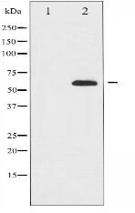 FOXO4 Antibody