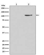 Phospho-GluR1 (S845) Antibody