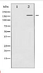 Phospho-EGFR (Tyr1016) Antibody