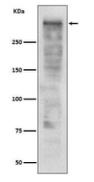 Ki67 Antibody