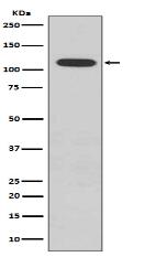 Phospho-Retinoblastoma (S807) Antibody