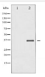 IkappaB-beta Antibody