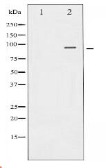 Catenin-β Antibody