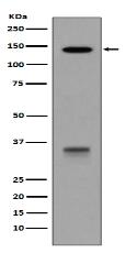 LDL Receptor Antibody