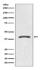 AGTR2 Antibody