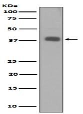 p57 Kip2 Antibody