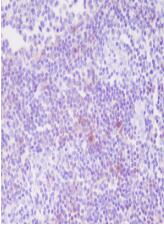 CD25 Antibody