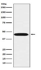 LIS1 Antibody