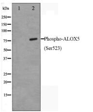 Phospho-ALOX5(Ser523) Antibody