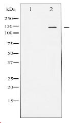 Phospho-eNOS (Ser1177) Antibody