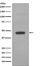 Cytokeratin 14 Antibody