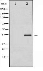 Phospho-C/EBP- beta (Thr235/188) Antibody