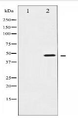 IKK-gamma Antibody