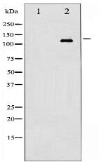 Phospho-EGFR (Ser695) Antibody