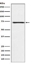 Guanylyl Cyclase beta 1 Antibody