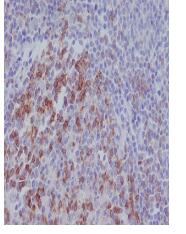 PD1 Antibody