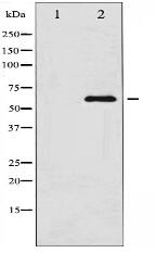 LIMK1 Antibody