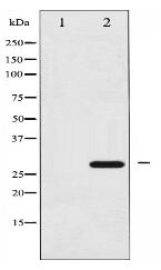 Phospho-14-3-3 zeta (Ser58) Antibody