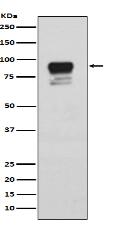 Phospho-Glycogen synthase 1 (S641) Antibody