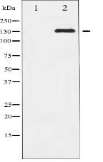 Phospho-EGFR (Ser1071) Antibody