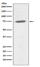 Phospho-BTK (Y551) Antibody