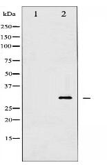 Phospho-14-3-3 zeta/ delta (Thr232) Antibody