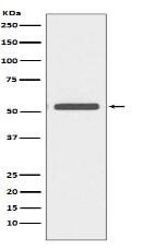 Cytokeratin 6 Antibody