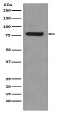 Androgen Receptor(AR-V7 specific) Antibody