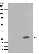 Phospho-Hsp27 (S78) Antibody