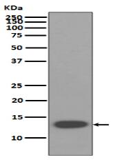 beta 2 Microglobulin Antibody