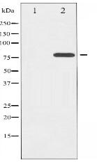 Phospho-ETK (Tyr566) Antibody