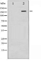 Phospho-EGFR (Tyr1197) Antibody