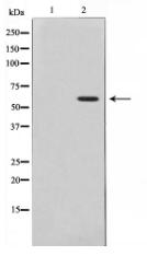 Phospho-Akt (Thr308) Antibody