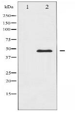 CaMK2 alpha/delta Antibody