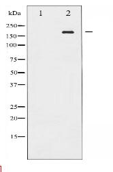 Phospho-ALK (Tyr1507) Antibody