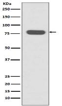 Radixin Antibody