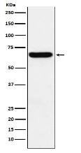 Methionine Aminopeptidase 2 Antibody