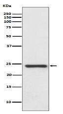 HSPB8/HSP22 Antibody