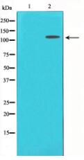 CD130/gp130 Antibody